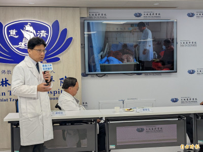 AI辨別新舊骨折 大林慈濟醫院與雲科大研究登期刊