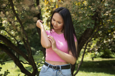 夏天皮膚搔癢增 中醫提醒別踩「隱藏地雷」