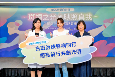白斑症麥可傑克森得過 醫：非傳染 可治療