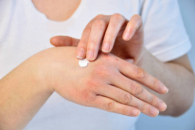 紅疹只擦藥膏？若是「皮蛇」帶狀皰疹 恐延誤治療