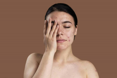 變胖、膚況差、毒素多皆因宿便？ 醫列3點破迷思