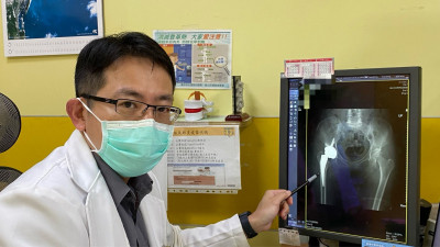 一痛20年！加拿大台僑椎間盤突出 回台2天治好