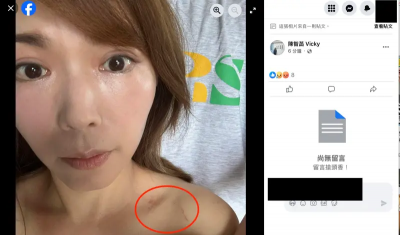 陳智菡「走讀」傷勢曝光　揭警察強推、抓項鏈：要辦就來！