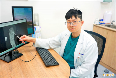 拇指外翻 年輕族群、男性比例上升