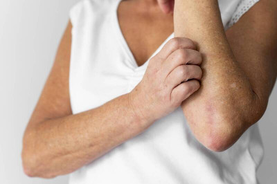 皮膚皸裂、脫屑、乾癢 中醫4招緩解