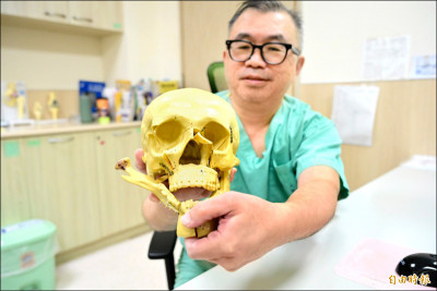 顏面骨折 「隱形切口」重建外貌不留疤