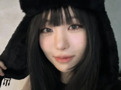 韓女星被前男友軟禁家暴！公開全身瘀青照公審　對方嚇到不敢聯絡