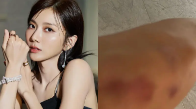 豆花妹蔡黃汝驚遭坦克車撞傷！經紀人報平安　竟是「他」釀禍