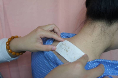 冬至後「三九貼」 中醫師：為來年調養身體