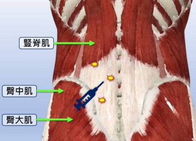 減重掉脂肪也掉肌肉 記得肌力訓練