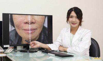 中年女臉部皺紋顯老態  雷射、玻尿酸注射讓她變年輕了