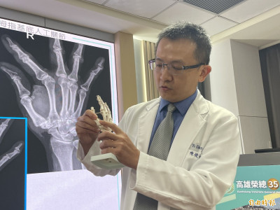 高榮引進新式拇指基底關節手術 助患者擺脫疼痛恢復握力