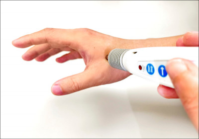 過敏性鼻炎 中藥＋雷射針灸治療改善