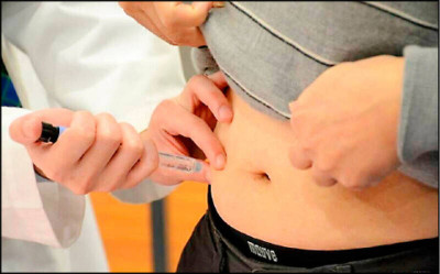 減肥手術後肌肉流失近12％ 研究：喫藥也一樣