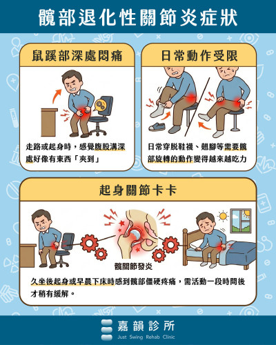 鼠蹊部悶痛、走路卡卡恐是髖關節炎  3組居家運動延緩退化