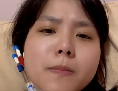 26歲山豬妹突住院裝人工血管！為捐骨髓前置超辛苦：痛到像被狗咬