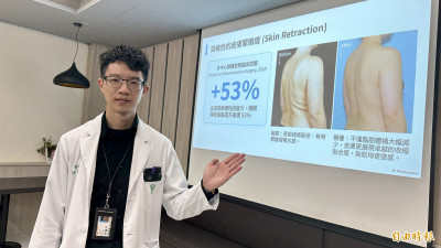 妙齡女愛運動仍甩不掉小腹贅肉  威塑超音波氣泡脂雕系統找回腰線