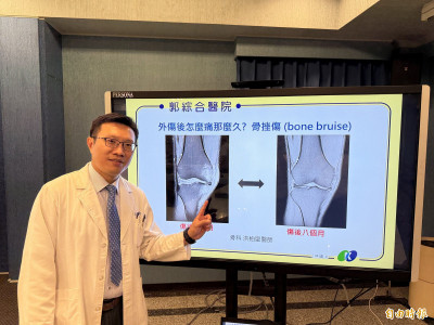 5旬男膝蓋遭工廠鐵球擊中骨挫傷  治療半年才脫離拐杖復工