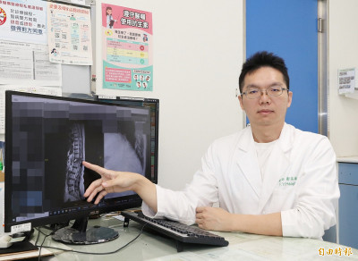 6旬婦跌倒起不來竟是胸椎壓迫性骨折  脊椎減壓併骨釘固定融合手術助康復