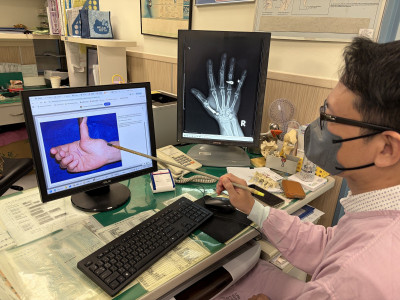拿盤子手軟摔破誤當媽媽手 中熟齡女拇指劇痛竟是「拇指基底關節」退化
