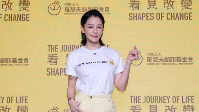 徐若瑄罹癌嘴開3洞！曝右側切除近況　親曝身上疤痕藏了20年